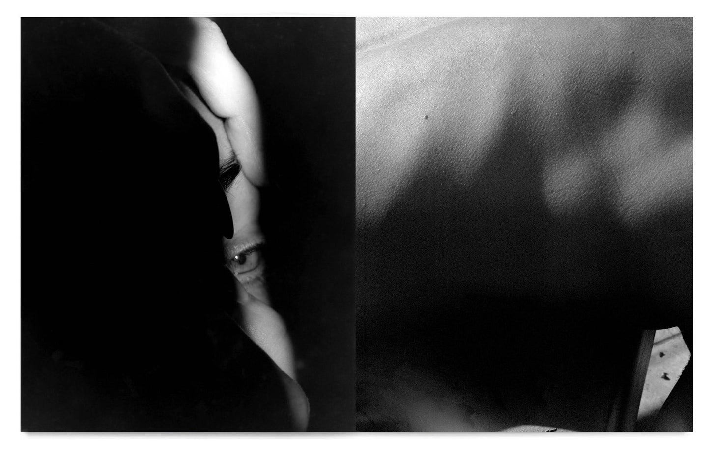 RADIUS [Signed]